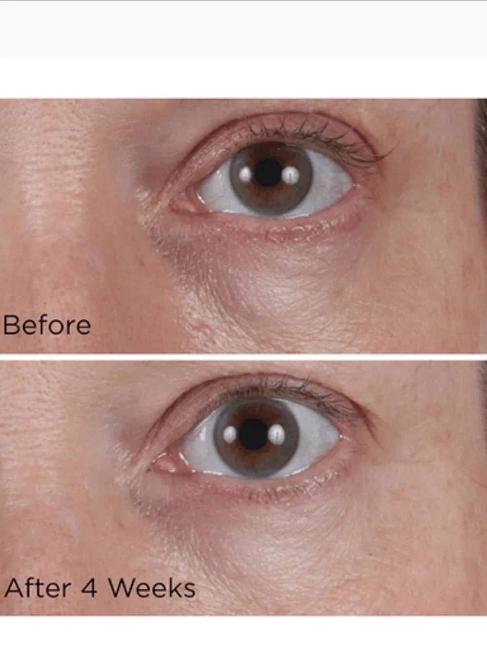 Perricone MD Eye Cream
